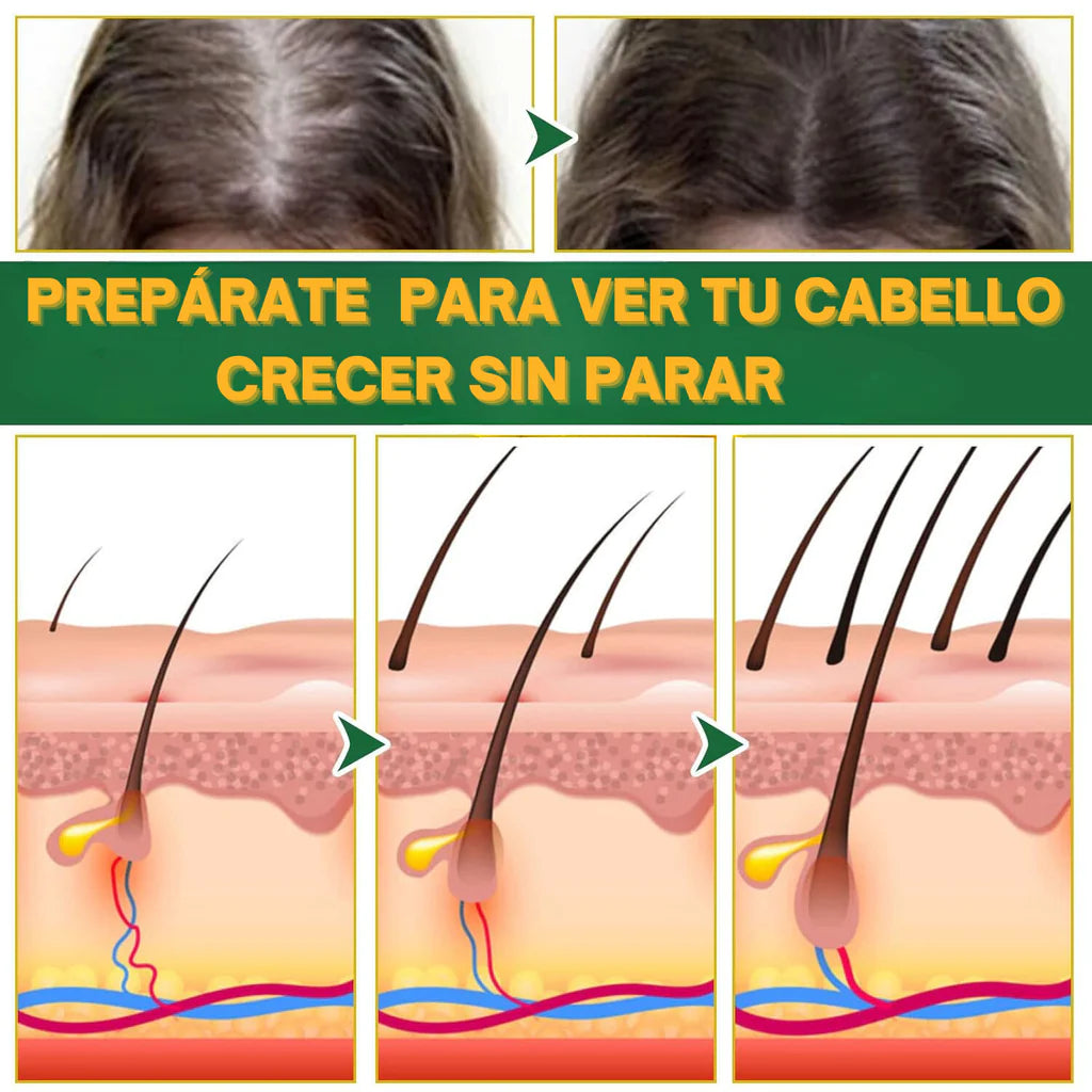 ELHOE HAIR™ - Suero para el crecimiento del cabello 🌿🧔